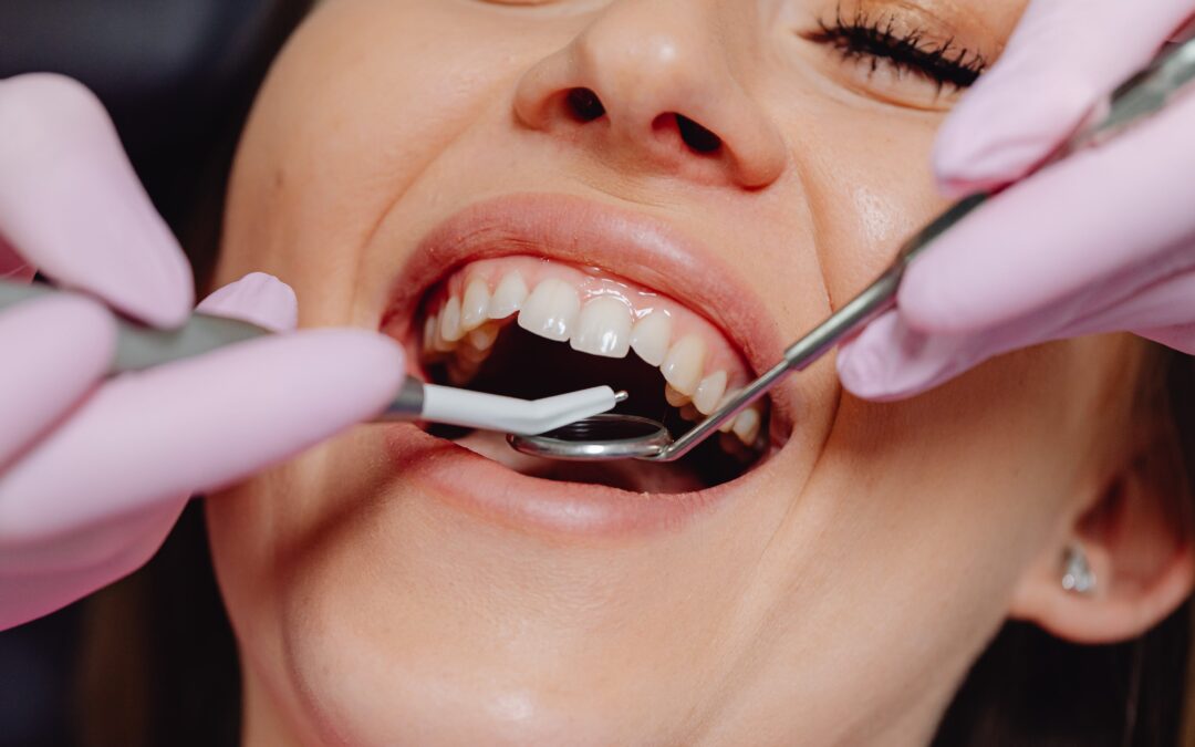 The Vital Connection: Healthy Gums for a Beautiful Smile